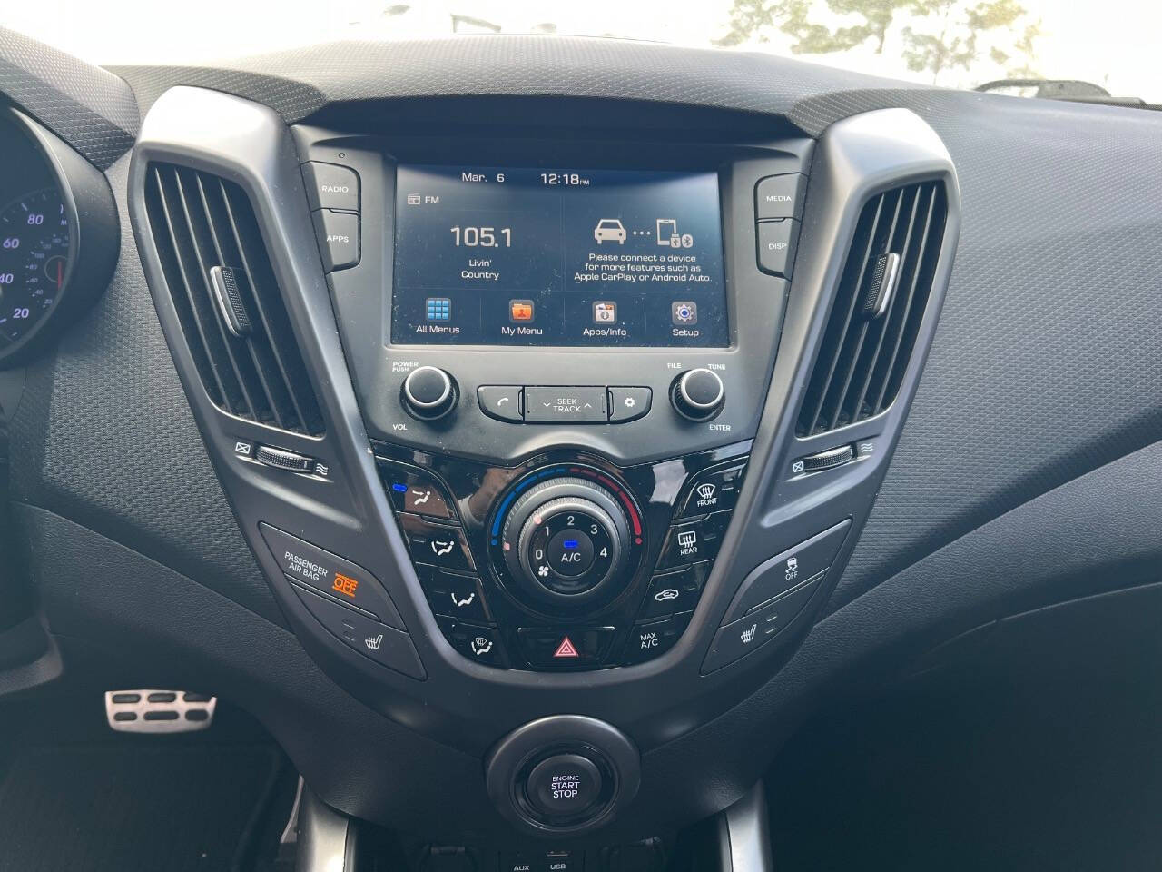 2017 Hyundai Veloster Turbo